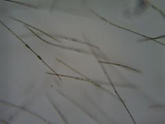 Dolichospermum planctonicum