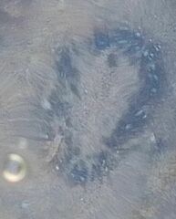 Anthopleura biscayensis