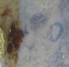 Anthopleura biscayensis