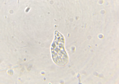 Hartmannellidae
