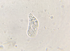 Hartmannellidae