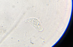 Hartmannellidae