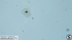 Vorticella campanula