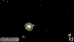 Vorticella campanula