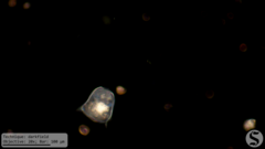 Vorticella campanula