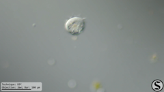 Vorticella campanula