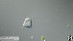 Vorticella campanula