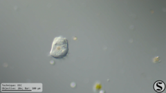 Vorticella campanula