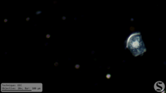 Vorticella campanula