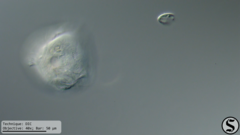 Vorticella campanula