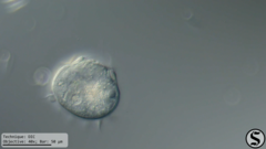 Vorticella campanula