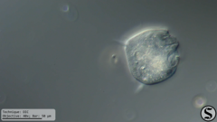 Vorticella campanula