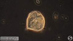 Vorticella campanula