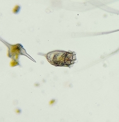 Keratella cochlearis