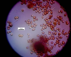 Chaenotheca chlorella
