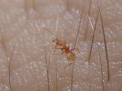Pheidole dentigula