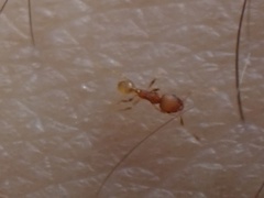 Pheidole dentigula