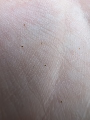 Eurytetranychus buxi