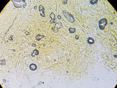 Melastiza cornubiensis