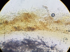 Melastiza cornubiensis