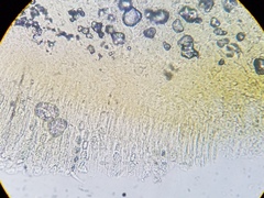 Melastiza cornubiensis