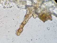 Melastiza cornubiensis