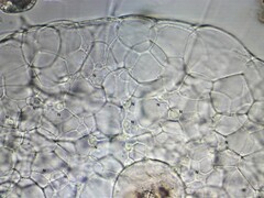 Actinosphaerium eichhornii