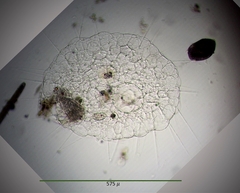 Actinosphaerium eichhornii