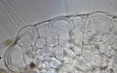 Actinosphaerium eichhornii