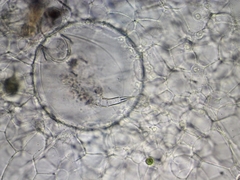 Actinosphaerium eichhornii