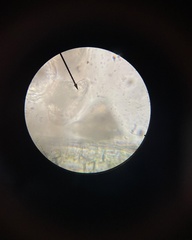 Vorticella campanula