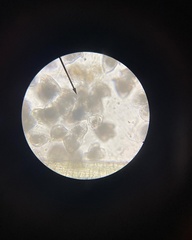 Vorticella campanula