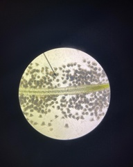 Vorticella campanula