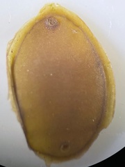 Erpobdellidae