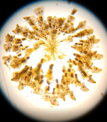 Conochilus hippocrepis