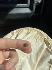 Agroiconota bivittata