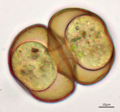 Arcella hemisphaerica