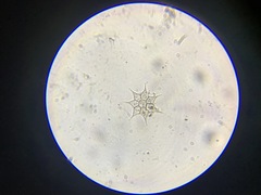 Monactinus simplex echinulatum