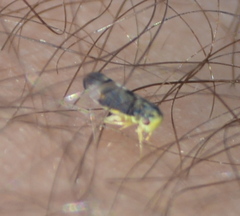 Pediopsoides distinctus