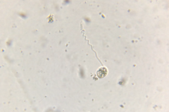 Vorticella