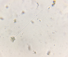 Vorticella