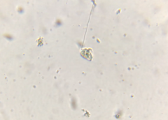 Vorticella