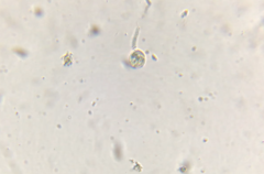 Vorticella