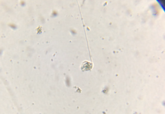 Vorticella