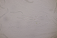 Cercophora mirabilis