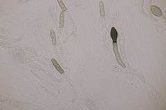 Cercophora mirabilis