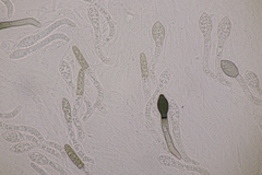 Cercophora mirabilis