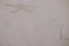 Cercophora mirabilis