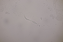 Cercophora mirabilis