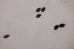 Cercophora mirabilis